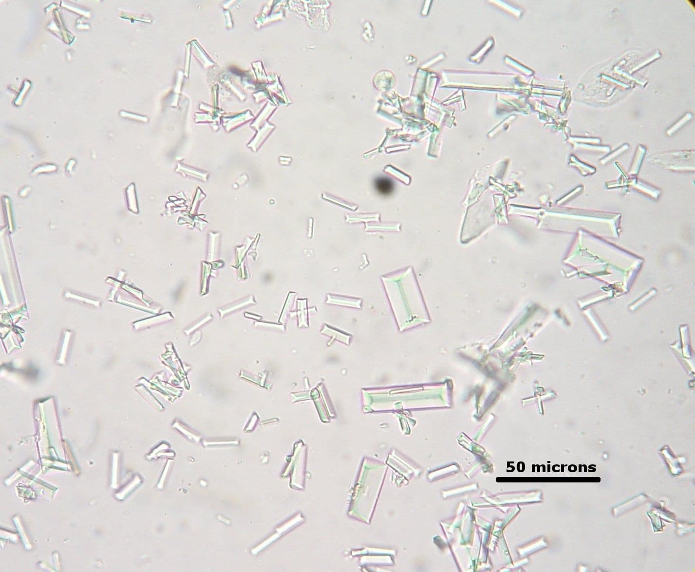 Struvite mineral